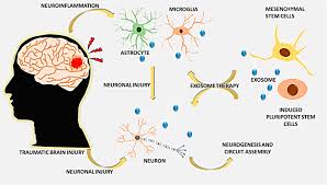 MSCs-Derived Exosomes and Neuroinflammation, Neurogenesis and Therapy of Traumatic Brain Injury